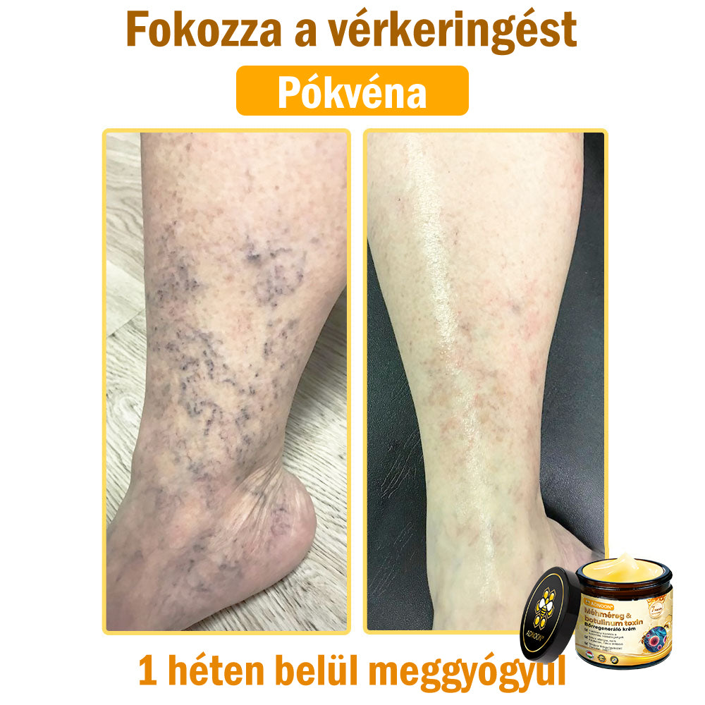 🎁🎁Már csak 5 doboz maradt! További 50%-os kedvezményt kínálunk! Szerezzétek vissza az alakotokat és egészségeteket. Most veszítsetek, és nem lesz több lehetőség jövő évig.