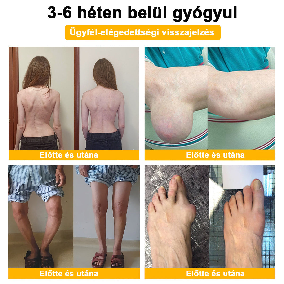 Már csak 10 doboz maradt!🎁 További 50% kedvezményt adunk! Legyél fitt és egészséges! Ha most kihagyod, jövőre már nem lesz rá lehetőséged.🎁🎁