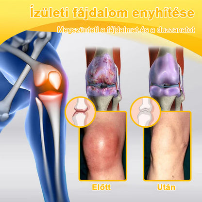 ArthroFree™ Méhméreg Fájdalomcsillapító Csontgyógyító Krém 🐝🌿 (Kifejezetten idősek számára & az AIPM ajánlja)🔥🔥