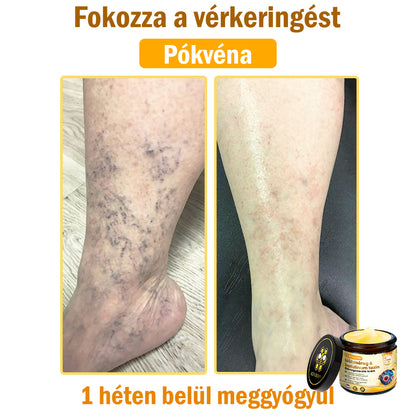 ADNOON® Méhméreg Bőrhelyreállító Krém (👨‍⚕‍CE jóváhagyott)👍✅