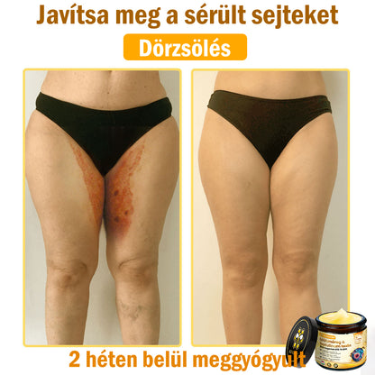 ADNOON® Méhméreg Bőrhelyreállító Krém (👨‍⚕‍CE jóváhagyott)👍✅