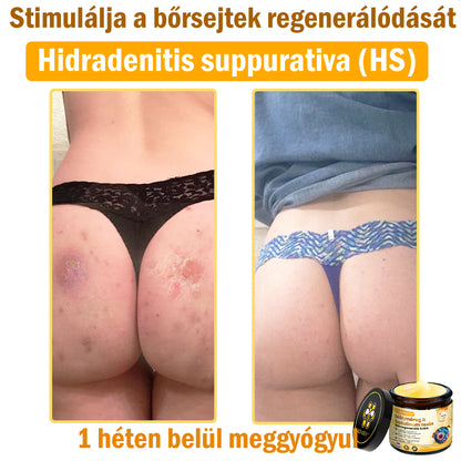 ADNOON® Méhméreg Bőrhelyreállító Krém (👨‍⚕‍CE jóváhagyott)👍✅
