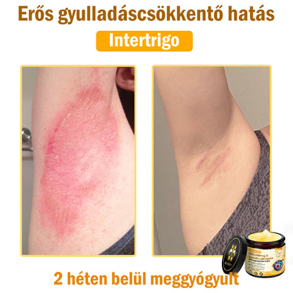 ADNOON® Méhméreg Bőrhelyreállító Krém (👨‍⚕‍CE jóváhagyott)👍✅
