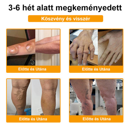 ArthroFree™ Méhméreg Fájdalomcsillapító Csontgyógyító Krém 🐝🌿 (Kifejezetten idősek számára & az AIPM ajánlja)🔥🔥