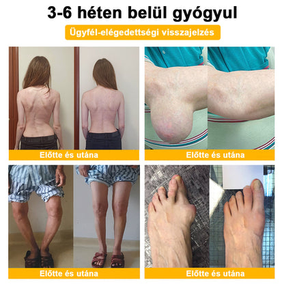 ArthroFree™ Méhméreg Fájdalomcsillapító Csontgyógyító Krém 🐝🌿 (Kifejezetten idősek számára & az AIPM ajánlja)🔥🔥
