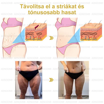 Már csak 10 üveg maradt!🎁 További 50% kedvezményt adunk! Legyél fitt és egészséges! Ha most kihagyod, jövőre már nem lesz rá lehetőséged