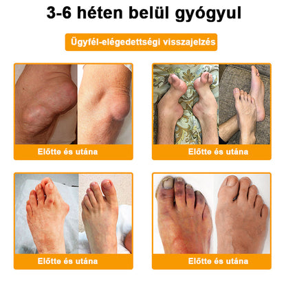 ArthroFree™ Méhméreg Fájdalomcsillapító Csontgyógyító Krém 🐝🌿 (Kifejezetten idősek számára & az AIPM ajánlja)🔥🔥
