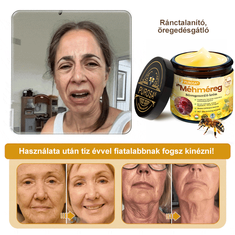 🐝 PUROSA® Méhméreg Fiatalító Krém｜ Átfogóan megoldja a makacs bőrproblémákat, mint például az öregedés, ekcéma, purpura, pikkelysömör stb.
