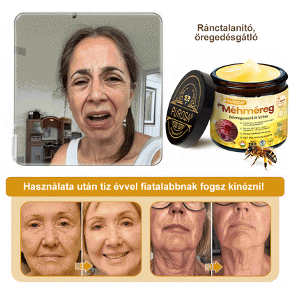 🐝 PUROSA® Méhméreg Fiatalító Krém｜ Átfogóan megoldja a makacs bőrproblémákat, mint például az öregedés, ekcéma, purpura, pikkelysömör stb.