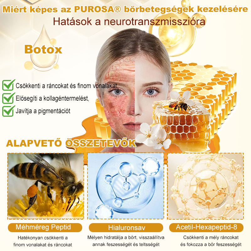 🐝 PUROSA® Méhméreg Fiatalító Krém｜ Átfogóan megoldja a makacs bőrproblémákat, mint például az öregedés, ekcéma, purpura, pikkelysömör stb.