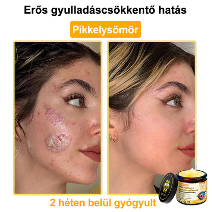 ADNOON® Méhméreg Bőrhelyreállító Krém (👨‍⚕‍CE jóváhagyott)👍✅