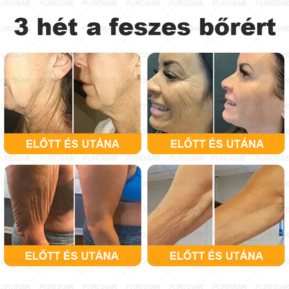 🐝 PUROSA® Méhméreg Fiatalító Krém｜ Átfogóan megoldja a makacs bőrproblémákat, mint például az öregedés, ekcéma, purpura, pikkelysömör stb.