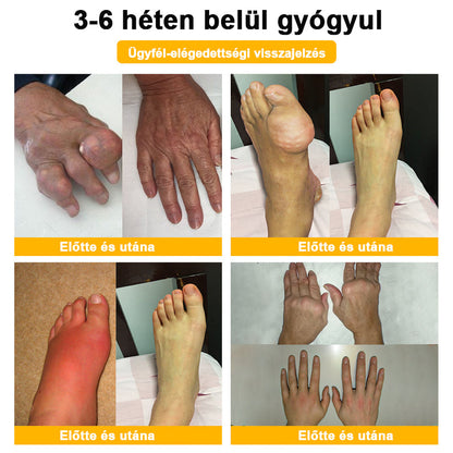 ArthroFree™ Méhméreg Fájdalomcsillapító Csontgyógyító Krém 🐝🌿 (Kifejezetten idősek számára & az AIPM ajánlja)🔥🔥