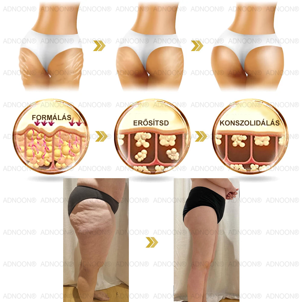 Már csak 10 üveg maradt!🎁 További 50% kedvezményt adunk! Legyél fitt és egészséges! Ha most kihagyod, jövőre már nem lesz rá lehetőséged