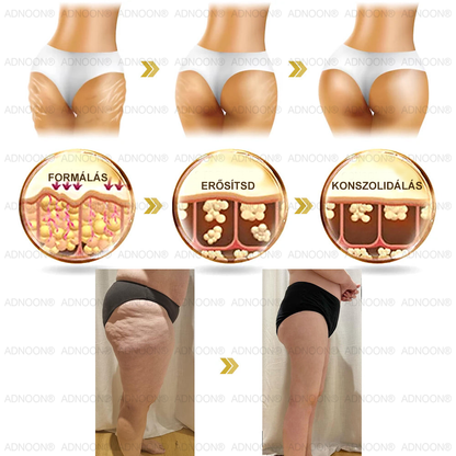 Már csak 10 üveg maradt!🎁 További 50% kedvezményt adunk! Legyél fitt és egészséges! Ha most kihagyod, jövőre már nem lesz rá lehetőséged