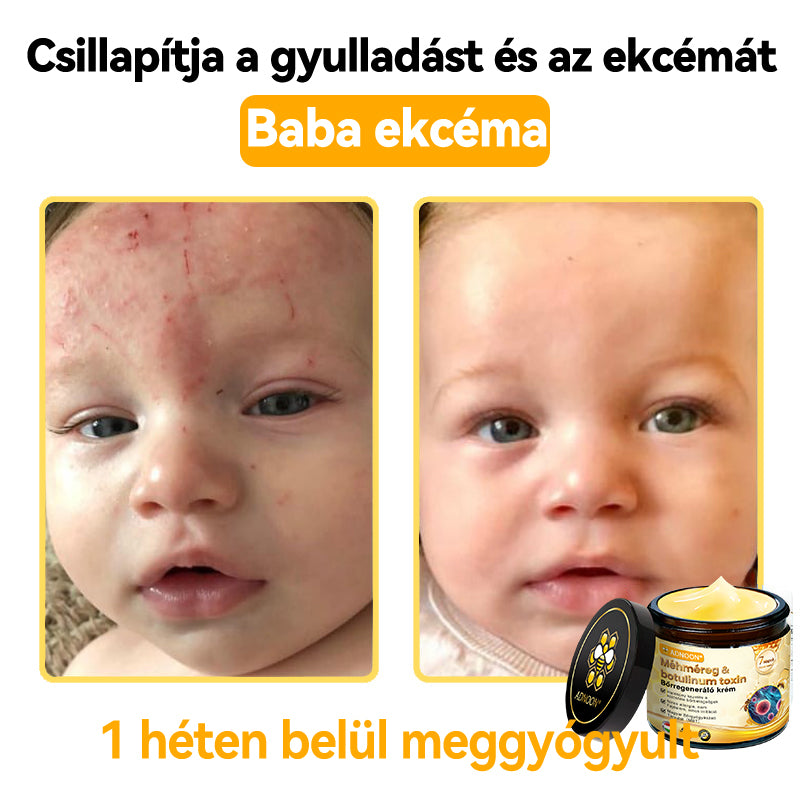 ADNOON® Méhméreg Bőrhelyreállító Krém (👨‍⚕‍CE jóváhagyott)👍✅