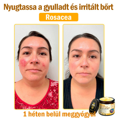 ADNOON® Méhméreg Bőrhelyreállító Krém (👨‍⚕‍CE jóváhagyott)👍✅