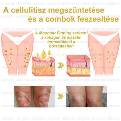 Már csak 10 üveg maradt!🎁 További 50% kedvezményt adunk! Legyél fitt és egészséges! Ha most kihagyod, jövőre már nem lesz rá lehetőséged
