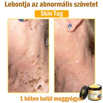 ADNOON® Méhméreg Bőrhelyreállító Krém (👨‍⚕‍CE jóváhagyott)👍✅