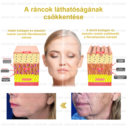 Már csak 10 üveg maradt!🎁 További 50% kedvezményt adunk! Legyél fitt és egészséges! Ha most kihagyod, jövőre már nem lesz rá lehetőséged