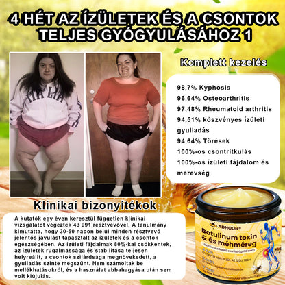 💧🐝ADNOON® Botulinum Toxin & Méhméreg Fájdalomcsillapító Csontgyógyító Krém👨‍⚕️A Magyar Ortopéd Társaság (MOT) Által Jóváhagyva