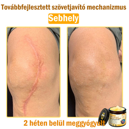 ADNOON® Méhméreg Bőrhelyreállító Krém (👨‍⚕‍CE jóváhagyott)👍✅
