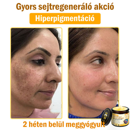 ADNOON® Méhméreg Bőrhelyreállító Krém (👨‍⚕‍CE jóváhagyott)👍✅