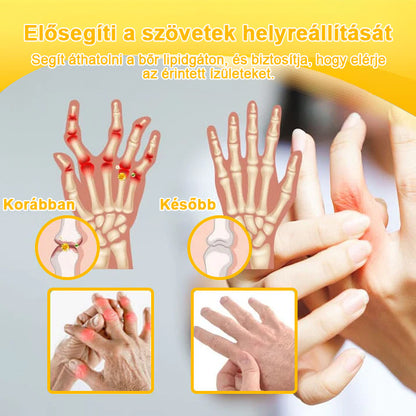 ArthroFree™ Méhméreg Fájdalomcsillapító Csontgyógyító Krém 🐝🌿 (Kifejezetten idősek számára & az AIPM ajánlja)🔥🔥
